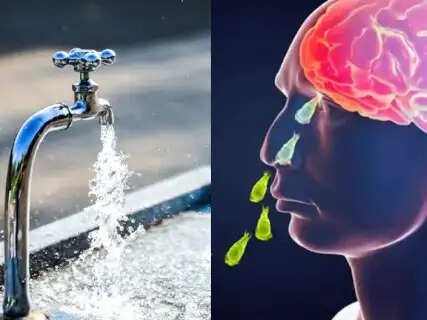 How Naegleria Fowleri Attacks from Water to the Brain and Crucial Warning Signs You Must Not Ignore