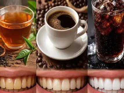 Tea, coffee, or cola: Which is the biggest stain contributor to your teeth
