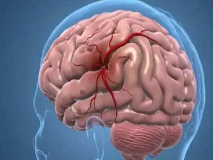 Research on 8,00,000 people revealed low birth weight might increase your risk of stroke in youth
