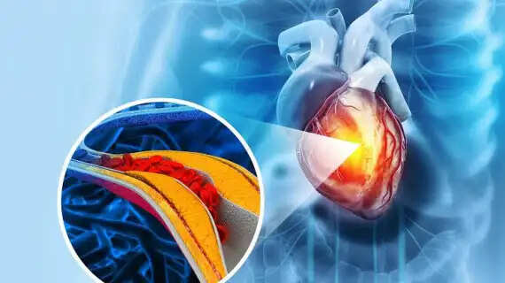 Say Goodbye to Daily Statins? Breakthrough Gene Therapy 'VERVE-102' Cuts Bad Cholesterol by 62% With Just One IV Injection