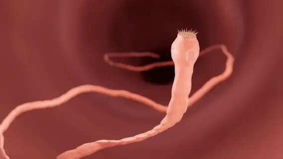 Medical Anomaly: How a Welsh Backpacker Developed 38 Parasites in Her Brain from a Silent Microscopic Infection