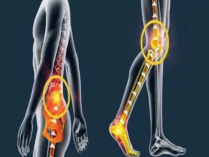 Knee and back pain bothering you? Do these simple exercises for 15 minutes every day.